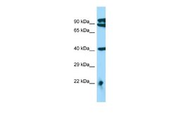 MTERFD3 Rabbit anti-Human, Polyclonal, Novus Biologicals 0.1ml; Unconjugated:Antibodies,
